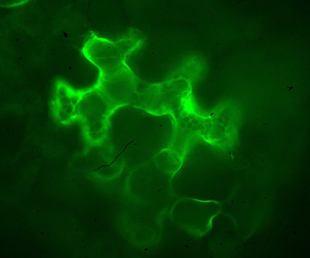 Image of a tubular cell that shows a fluorescent signal that is strongest at the periphery of the cell. In the middle of the cell punctuate dark areas are visible, that are due to the presence of chloroplasts.